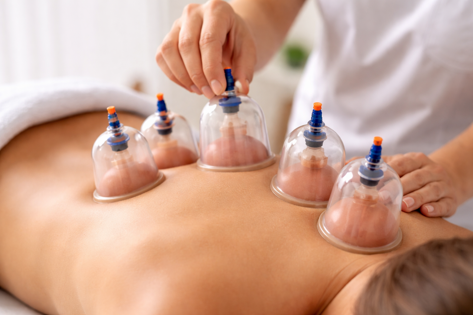 Cupping therapy physiotherapy Gurgaon
